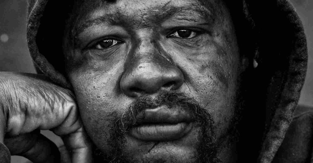 Close-up image of a Black man experiencing homelessness with teary tired eyes.